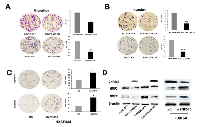 Figure 2:  ZNF545 inhibits cell migration and invasion in HCC cells. 