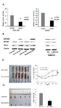 Figure 3:  ZNF545 suppresses HCC cell growth by inhibiting NF-kB signaling and ZNF545 suppresses human HCC  cell tumor growth in xenograft mice. 