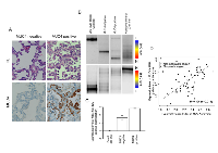 Figure 1: Analysis of MUC4 expression and methylation status in human lung samples. 