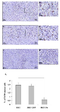 Figure  5:  Immunohistochemistry  of  tumor  xenografts  from  D6/ACKR2  deficient  and  proficient  BHT  cells. 