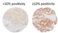 Figure 2: EGFR staining scored by image analysis. 