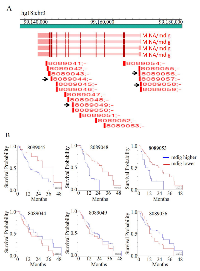 Figure 5:  The levels of mdig expression predict survival of the patients with pancreatic cancer. 