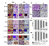 Figure 1: Inhibitory effects of resveratrol on cervical squamous cell carcinoma SiHa and adenocarcinoma HeLa cells. 