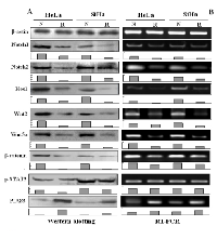 Figure 2:  Statuses of STAT3, Notch and Wnt signaling  in SiHa and HeLa cells and the influences of resveratrol  in them. 