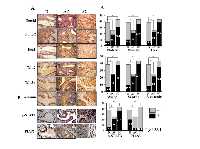 Figure 4:  Frequencies of Notch1, Notch2, Wnt2 and Wnt5a detection and nuclear translocation of Hes1, β-catenin,  p-STAT3 and PIAS3 in human cervical cancer specimens. 