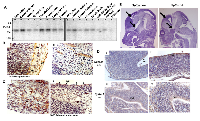 Figure 2:  PJA1 expression in brain. 