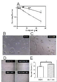Figure 1: DLD-1-OxR exhibited resistance to oxaliplatin, mesenchymal cell morphology and increased cell migration  compared to parental cells. 