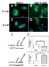 Figure 2:  DLD-1-OxR exhibited mesenchymal markers. 