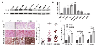 Figure 1: SIRT6 is overexpressed in melanoma cells and clinical tissues. 