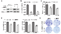 Figure 2:  SIRT6 knockdown inhibits proliferation and colony formation in melanoma cells. 