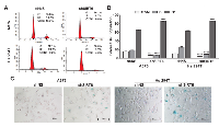 Figure 3:  SIRT6 knockdown induces G1-phase arrest and senescence-like phenotypes in human melanoma cells. 