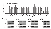 Figure 6:  Validation of modulations in autophagy-related markers after SIRT6 knockdown in melanoma cells. 