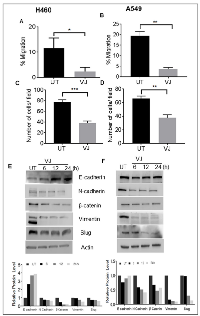 Figure 7:  VJ inhibits EMT in H460and A549 lung cancer cells. 