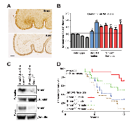 Figure 2:  Geminin loss of function enhances survival in the SmoA1 medulloblastoma model. 