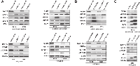 Figure 4:  Pappalysin-1 silencing results in accumulation of IGFBPs and reduced IGF signaling in Ewing sarcoma  cells. 