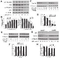 Figure 5:  ATR, but not ATM, is involved in CPX-induced Cdc25A degradation. 