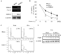 Fig 1: Effect of NDRG2 overexpression on glucose  deprivation-mediated apoptosis in MDA-MB-231  cells. 