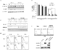 Fig 2:  NDRG2 overexpression attenuates glucose deprivation-induced AMPK activity. 