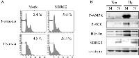 Fig 4:  Effect of NDRG2 overexpression on hypoxia-induced apoptosis. 