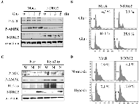 Fig 6:  NDRG2 overexpression enhances glucose deprivation- and hypoxia-induced apoptosis in HCT116 colon cancer  cells. 
