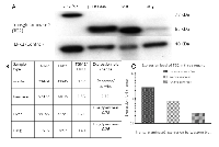 Figure7:  Expression of transglutaminase2 (TG2) in four environments. 