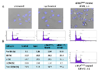 Figure 9:  Nuclear morphology and cell cycle distribution of Suit2-007 cells following knockdown of TGM2 by siRNA. 