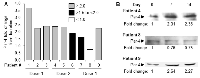 Figure 1: Induction of plasma Par-4 in cancer patients treated with HCQ. 