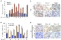 Figure 2: HCQ induced apoptosis and p62 levels in tumors. 