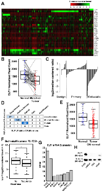 Figure 1: ELF1 is the most commonly downregulated ETS factor in prostate cancer. 