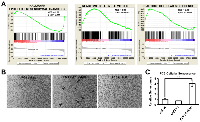 Figure 4: ELF1 represses EMT, but activates cellular senescence. 