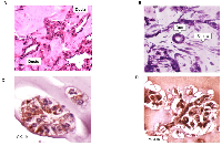 Figure 2:  Organization of cells into ductal and stromal compartments in 3D organoids. 