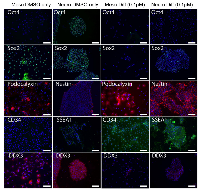 Figure 4:  DDX3 inhibition promotes hESC differentiation after 4 days in culture. 