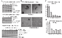 Figure 2:  Inhibition of Mirk kinase induces apoptosis and reduces quiescence markers in two ovarian cancer cell lines  made into spheroids. 