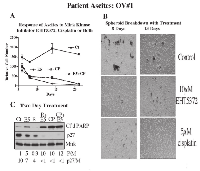 Fig.3:  Mirk kinase inhibitor reduces ascites spheroids of ovarian cancer patient #1 to single cells, which then undergo  apoptosis. 