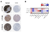 Figure 6:  Investigation of potential biomarkers at protein levels in HCC and expression fold-change across cancers. 