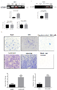 Figure 1: Comparison of potential aggressive/metastatic phenotype of OS cell lines in vitro. 