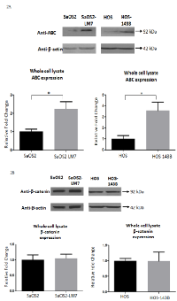 Figure 2:  Cellular level of ABC increases with OS progression.  