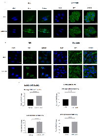 Figure 4:  Cellular localization and quantification of ABC fluorescence intensity in OS cell lines. 