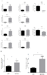 Figure 5:  Transcriptional activity of ABC/β-catenin increases with OS progression. 