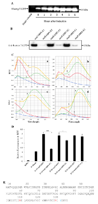 Figure 1: Production of recombinant FABP5s in E.  