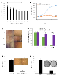 Figure  2:  DmrFABP5  significantly  suppressed  the  proliferation,  migration,  invasion  and  anchorage-independent  growth of PC3-M cells. 