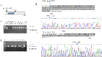 Figure 3: A. Schematic representation of the primer design to detect the CPE transcript variant. Due to the inner deletion in CPE exon1, primer set 134/667 generates a 534bp PCR product for WT-CPE, and a 336bp PCR product if there is Δ189-386 in CPE mRNA; B., C. RT-PCR was performed with cDNA derived from various cancer cell lines and liver cancer patients using primer set CPE F134/R667. Three CPE amplicons were amplified, upper band 534bp (wild type, upper arrow), middle band 436bp ;(Δ288-385, middle arrow), bottom band, 336bp (Δ189-386, bottom arrow). B: cell lines are indicated, HCC CS is a HCC patient tumor sample, C: HCC patients #1-9; 10, WT-CPE plasmid; 11, CPEΔ189-386 plasmid. Note the presence of all 3 amplicons in HCC97H cells and in HCC patient samples in varying amounts. D., E. The two small size PCR products were purified and subjected to DNA sequencing. Sequence alignment with WT-CPE (homo sapiens CPE NM001873.2) confirmed two deletion forms, Δ189-386 (upper) and Δ288-385(lower). Sequences in shaded area indicate deleted region in both forms.