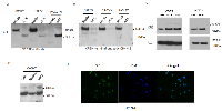 Figure 4:  Expression of CPE and CPE-∆N protein in various cancer cells.