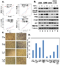 Figure 4:  TMEPAI reverses Smad3 gene knockdown effects. 