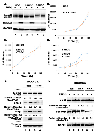Figure 6:  Knockdown of TMEPAI or Smad3 promotes epithelial markers and reduces mesenchymal and metastatic  markers in HCC1937 cells. 