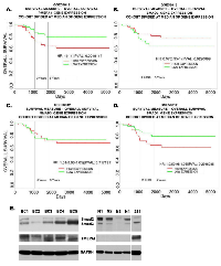 Figure 7:  High Expression of TMEPAI/PMEPA1 and low expression of Smad2 are associated with poor prognosis of  TNBC patients. 