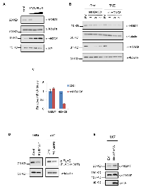 Figure 2:  HDAC8 regulates MGMT protein levels. 