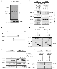 Figure 3:  HDAC8 binds to ADRM1 through the PRU domain. 