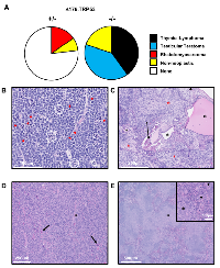 Figure 3:  Tumor spectrum of SJL/J ∆176.Trp53  mouse. 