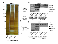 Figure 4:  PJA1 interacts with HMGA2 in nuclear compartments of HCC cells. 